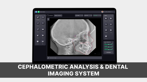 Cephalometric Analysis & Dental Imaging System